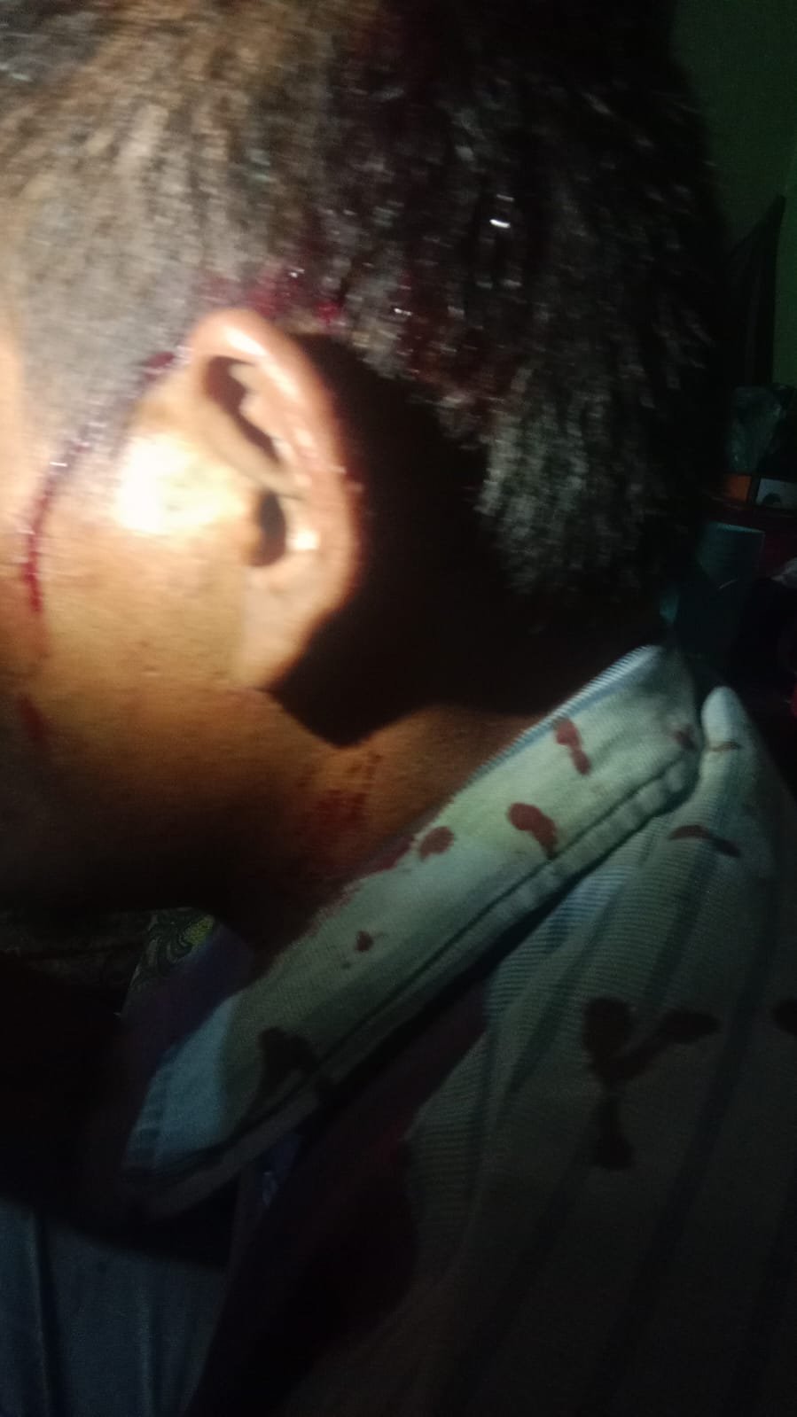 Penegak Hukum Diminta Serius Tangani Kasus Penganiayaan Oleh Oknum Rentenir Dengan Senjata Api