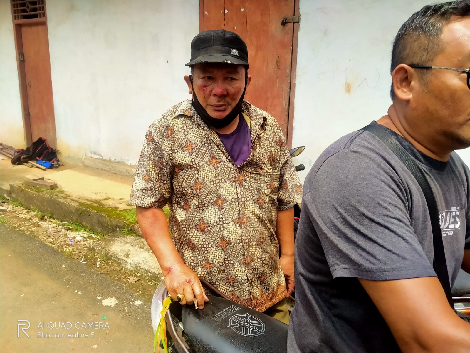 Tabrakan di Persimpangan SD 2 Banyu Urip, Lansia Alami Luka Serius